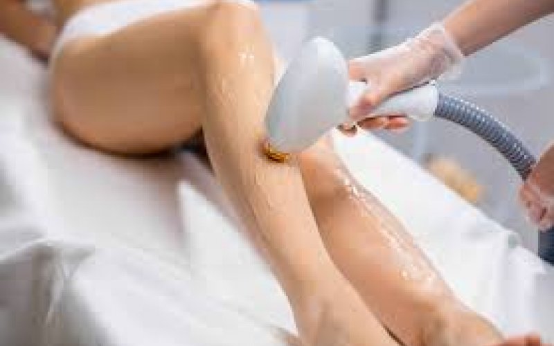 Lazer Epilasyon Nedir, Nasıl Yapılır? – Enza Eryaman